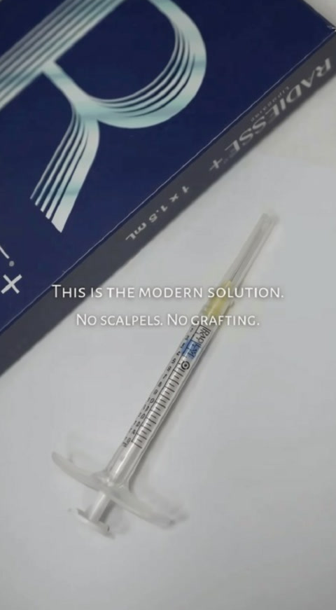 A Radiesse® (+) syringe next to its box