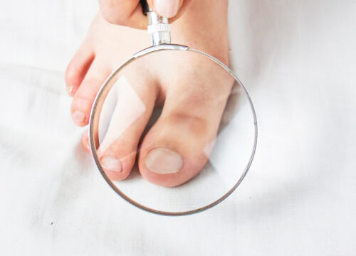 Photo of a person holding a magnifying glass up to their foot