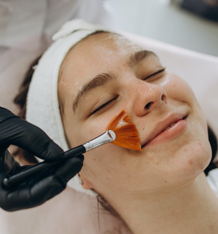 Photo of a woman getting a chemical peel