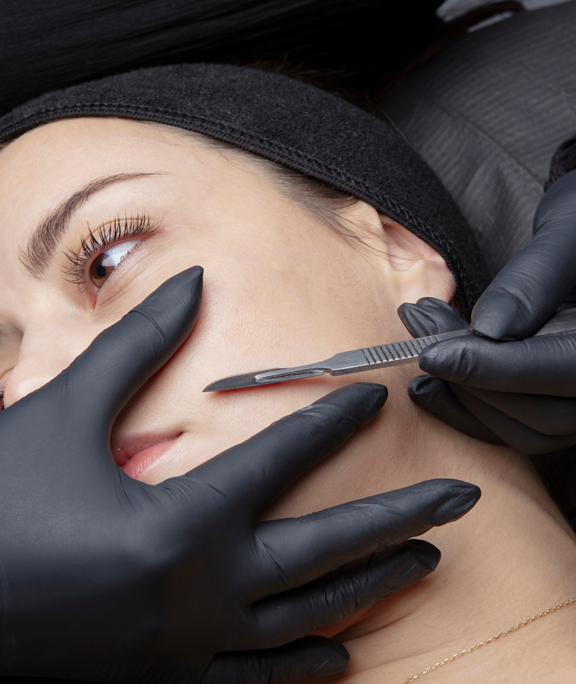 Photo of a woman receiving a dermaplaning treatment